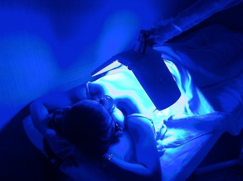 Blue Light (แสงสีฟ้า) ช่วยยับยั้งปัจจัยการเกิดสิวและป้องกันการติดเชื้อใหม่ 