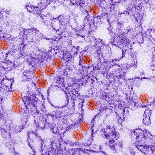 Malaysia on Thursday reported its first suspected case of Zika, a 58-year-old woman believed to have contracted it in neighbouring Singapore where more than 100 cases have been confirmed. -- Photo: AP