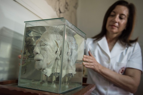 Lima: Doctor Diana Rivas holds a glass container with a human head immersed in formaldehyde at the Museum of Neuropathology in Lima on November 16, 2016. AFP/Ernesto Benavides
