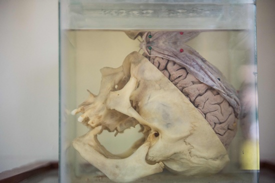 Lima: A glass container with a human skull and brain immersed in formaldehyde is displayed at the Museum of Neuropathology in Lima on November 16, 2016. AFP/Ernesto Benavides