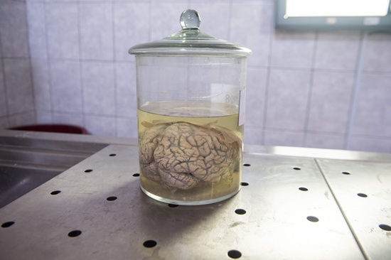 Lima: A human brain immersed in formaldehyde is displayed at the Museum of Neuropathology in Lima on November 16, 2016. AFP/Ernesto Benavides