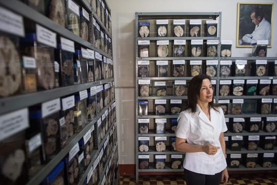 Lima: Doctor Diana Rivas speaks during an interview, beside a collection of human brains presenting different pathologies at the Museum of Neuropathology in Lima on November 16, 2016. AFP/Ernesto Benavides