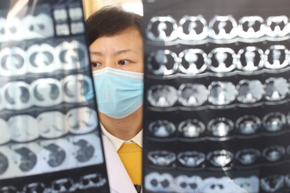 (แฟ้มภาพซินหัว: แพทย์จากแผนกมะเร็งของโรงพยาบาลประชาชนกุ้ยโจว ในเมืองกุ้ยหยาง มณฑลกุ้ยโจว ทางตะวันตกเฉียงใต้ของจีน ตรวจดูผลซีทีสแกนของผู้ป่วย เมื่อวันที่ 16 เม.ย. 2020)