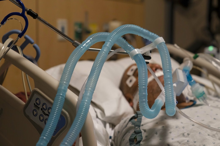 คนไข้โรคโควิด-19 ซึ่งต้องใช้เครื่องช่วยหายใจ ที่โรงพยาบาลแห่งหนึ่งในเมืองลอสแองเจลิส รัฐแคลิฟอร์เนีย (ภาพถ่ายเมื่อ 19 พ.ย.) 