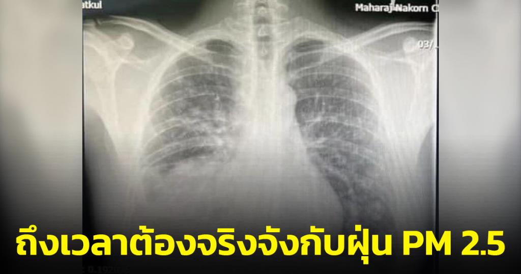 “หมอแล็บแพนด้า”  ชี้ถึงเวลาต้องจริงจังกับฝุ่น PM 2.5 หลังเจอเคส หมอเป็นมะเร็งปอดระยะสุดท้าย