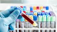 กรมวิทย์ลุยตรวจเลือดหา "ยีน" ป้องกันไม่ติดเชื้อโควิด พัฒนายาปิดทางด่วนรับเชื้อ