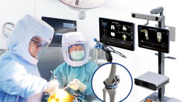 ผ่าตัดข้อเข่าเสื่อมด้วย “Robotic Assisted Surgery”