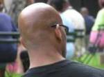 Man beaten for being bald
