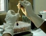 มีหวังได้ทางสู้ HIV หลังพบ 2 ยีน ช่วยกำจัดเซลล์ติดเชื้อมรณะ