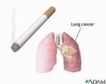 Fathers, Thai men urged to stop smoking to be Children’s Day gift