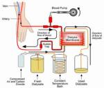 Dialysis cost raised for kidney patients