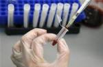 New technique gives big picture of AIDS gene map
