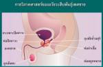 เมื่อ...ต่อมลูกหมากโต