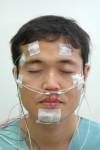 โรค Narcolepsy  หลับได้ทุกที่