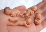 สบส.จับตาคลินิกต้องสงสัยทำแท้งเถื่อน 50 แห่ง แฉรีดลูกติดเชื้อนับหมื่น