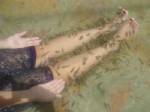สบส.เตือนประชาชนติดเชื้อจาก “สปาปลา”