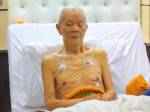 รอง ผอ.รพ.มหาราชโคราช ยัน “พ่อคูณ” อาพาธเป็น “วัณโรค”