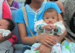 อุบลฯผ่าตัดปากแหว่งเพดานโหว่เฉลิมพระเกียรติในหลวง