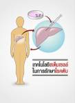 ใช้แสงซินโครตรอนพัฒนา “สเต็มเซลล์” สู้ “มะเร็งตับ”
