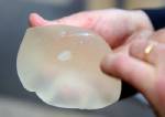 Women urged not to panic over breast implant scare