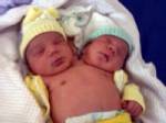 No surgery for now on two-headed baby in Brazil: doctors