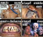 นานาประเทศเชียร์ไทยเพิ่มขนาดคำเตือนบนซองบุหรี่เป็น 85%