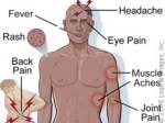 3 อาการอันตราย ‘ไข้เลือดออก’ / คอลัมน์ Health Line สายตรงสุขภาพ