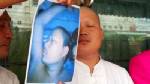 ตบหน้า “น้องเณรคำ” อ้างอ้วนใบหูเปลี่ยน หมอชี้รูปทรงหูถาวรตั้งแต่ 7 ขวบ