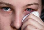 สธ.ชี้แค่ 7 เดือนของปี 56 พบผู้ป่วยโรคตาแดงกว่า 6 หมื่นราย