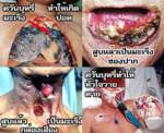 บ.ยาสูบสะใจ! ศาล ปค.สั่งระงับ กม.เพิ่มขนาดภาพคำเตือนซองบุหรี่