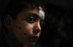 UNICEF Photo of the Week : ยูนิเซฟระดมทุนช่วยเหลือเด็กๆ ในซีเรีย