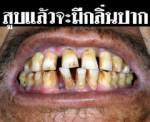 ภาคีเครือข่ายฯ หนุนขยายภาพคำเตือนบนซองบุหรี่