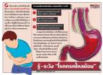 รู้-ระวัง “โรคกรดไหลย้อน”