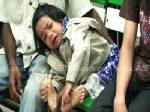 หนูน้อยวัย 6 ขวบ ที่ จ.ตรัง ป่วยเป็นโรคฝ่าเท้าหนา วอนผู้ใจบุญช่วยเหลือ