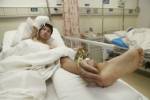 ตะลึง! หมอจีนปลูกถ่าย “มือ” ติด “ข้อเท้า” ฟื้นฟูอวัยวะก่อนผ่าตัดคืนตำแหน่งเดิม