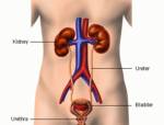 แพทย์ชี้ เบาหวาน-ความดัน ต้นเหตุสำคัญโรคไต/คอลัมน์ Health Line สายตรงสุขภาพ