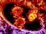 ซาอุฯ เผย มีผู้เสียชีวิตจากไวรัส “MERS” เพิ่มอีก 5 ราย - WHO เร่งอุดช่องโหว่เชื้อลามใน รพ.