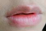 ทำอย่างไร! เมื่อริมฝีปากแห้งลอก