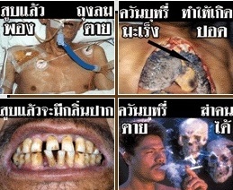 วอนบังคับใช้ กม.คุมบุหรี่หลังพบผิดกม.อื้อ จับตาภาพคำเตือนบนซอง 85 %  23 ก.ย. นี้