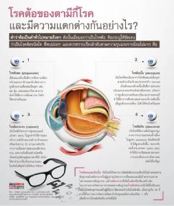 โรคต้อของตามีกี่โรค และมีความแตกต่างกันอย่างไร?