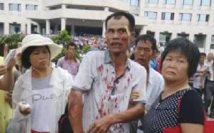 ตำรวจสลายม็อบค้านไล่ที่ในซัวเถา จนเกิดเหตุปะทะเลือดอาบ