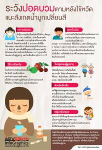 ระวังปอดบวมตามหลังไข้หวัด แนะสังเกตน้ำมูกเปลี่ยนสี