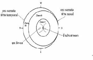 จอตาผิดปกติในเด็กคลอดก่อนกำหนด