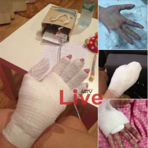 ระวัง! ถ้าคิดจะเล่นกับไฟ 	อุทาหรณ์..ถ่ายรูปเล่นกับไฟเย็น