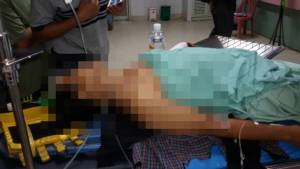 คนร้ายซุ่มยิง ผญบ.ชาวม้งเจ็บพร้อมลูกสาววัย 4 ขวบ