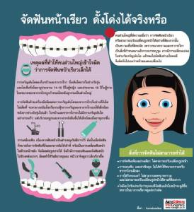 จัดฟันหน้าเรียว ดั้งโด่งได้จริงหรือ