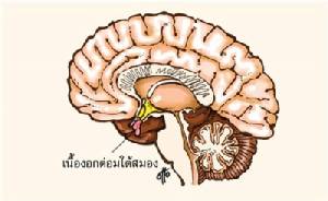 “มนุษย์ยักษ์” อะโครเมกาลี โรคที่ไม่คุ้นเคยแต่เป็นอันตรายถึงชีวิต