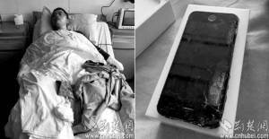 ไอโฟน 5s ระเบิดระหว่างชาร์จแบต ไอ้หนุ่มจีนหน้าเสียโฉม-คอไหม้