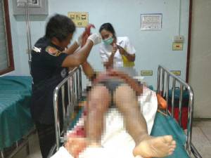 ทะเลาะวิวาท! วัยรุ่นรุมแทงรองนายก อบต.ตะแพน พรุน 9 แผลดับคาร้านคาราโอเกะ