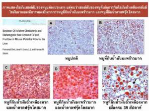 "น้ำมันถั่วเหลือง" ทำให้เป็นโรคอ้วนและโรคเบาหวาน ง่ายยิ่งกว่า "น้ำมันมะพร้าว" และ "น้ำตาลจากผลไม้"?